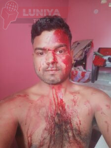 टुण्डी में मामूली विवाद बना खूनी संघर्ष, दो लोग गंभीर रूप से घायल 5 WhatsApp Image 2025 04 04 at 6.56.45 PM