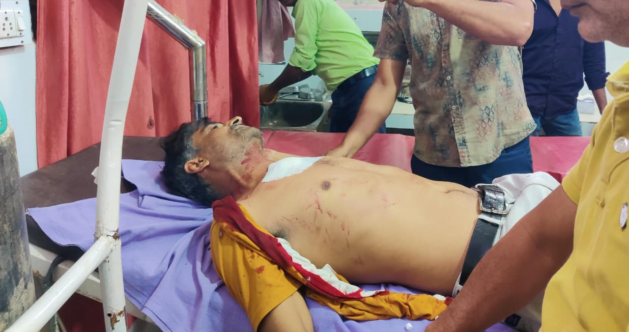 त्रिमूर्ति चोराहे पर गोलीबारी से मचा हड़कंप, सलीम खां गंभीर घायल 1 WhatsApp Image 2025 10 15 at 18.04.47