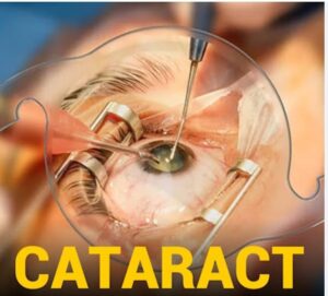 रियायती दर पर मोतियाबिंद (Cataract) ऑपरेशन – पूरी जानकारी 6 IMG 20260326 WA0007
